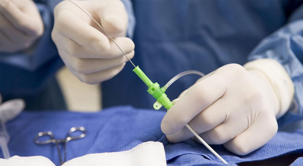 cómo se realiza un cateterismo cardíaco paso a paso, procedimiento de cateterismo cardíaco explicado por cardiólogo, Dr. Ramiro Méndez cateterismo cardíaco guía, qué esperar en un cateterismo cardíaco diagnóstico, cardiólogo en México experto en cateterismo cardíaco, doctor cardiologo en guadalajara, el mejor cardiólogo en guadalajara, cardiologo cerca de aquí, ecocardiograma doppler color en guadalajara, consulta de cardiólogo hoy mismo, Holter de 24 hrs, holter de arritmias en guadalajara,