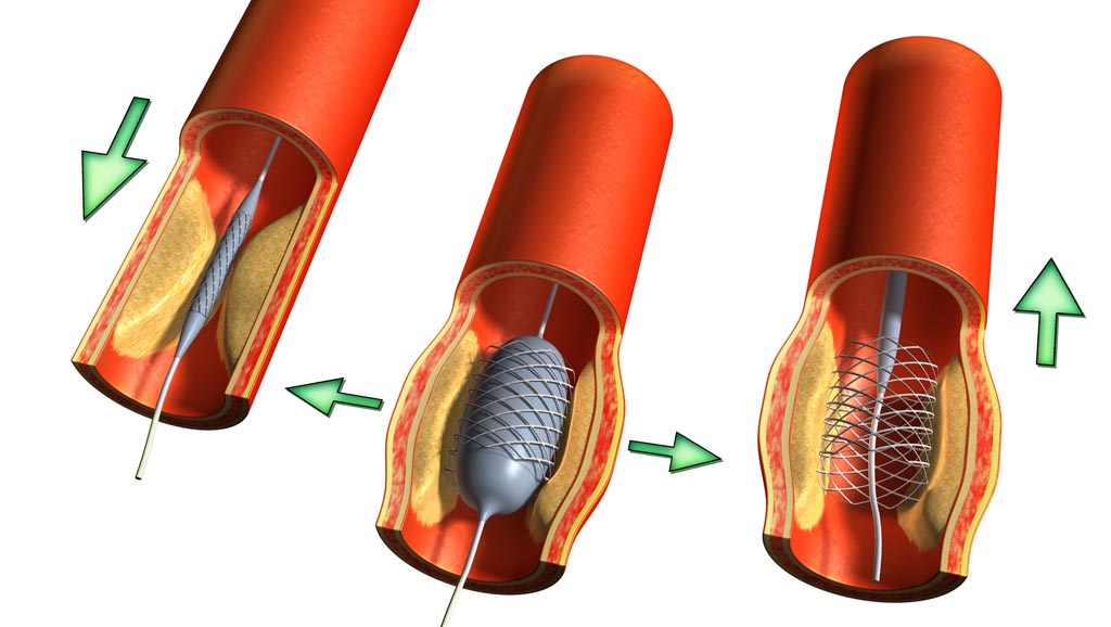 doctor cardiologo en guadalajara, el mejor cardiólogo en guadalajara, cardiologo cerca de aquí, ecocardiograma doppler color en guadalajara, consulta de cardiólogo hoy mismo, Holter de 24 hrs, holter de arritmias en guadalajara,
