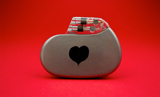 doctor cardiologo en guadalajara, el mejor cardiólogo en guadalajara, cardiologo cerca de aquí, ecocardiograma doppler color en guadalajara, consulta de cardiólogo hoy mismo, Holter de 24 hrs, holter de arritmias en guadalajara,