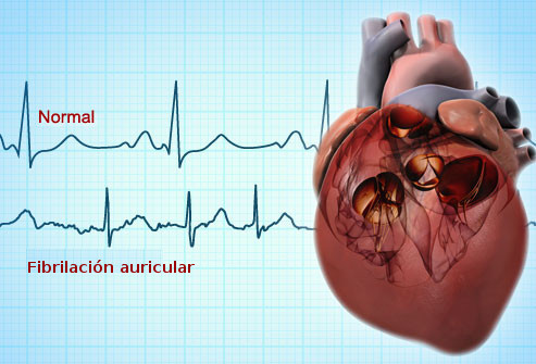 doctor cardiologo en guadalajara, el mejor cardiólogo en guadalajara, cardiologo cerca de aquí, ecocardiograma doppler color en guadalajara, consulta de cardiólogo hoy mismo, Holter de 24 hrs, holter de arritmias en guadalajara,